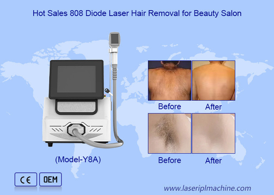 কার্যকর 1200W-1600W চুল অপসারণ Epilator 808nm ডায়োড লেজার মেশিন
