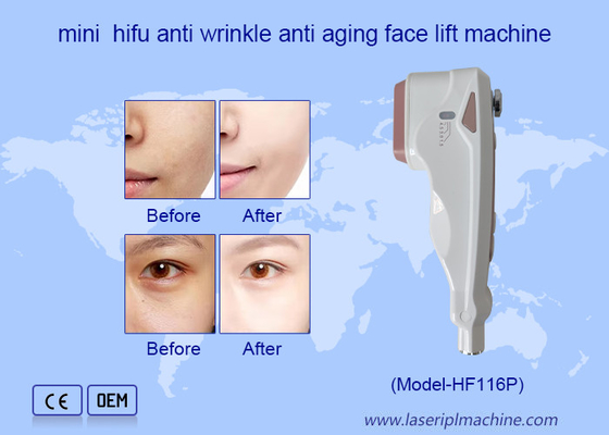 হোম ব্যবহার HIFU যত্ন মুখের wrinkle অপসারণ ত্বক পুনরুজ্জীবন মুখ উত্তোলন মেশিন