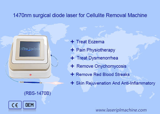 ভালো দাম 1470nm 980nm ডায়োড লেজার লিপোলাইসিস সার্জারি লেজার ডিভাইস ফ্যাট দ্রবণীয় অনলাইন
