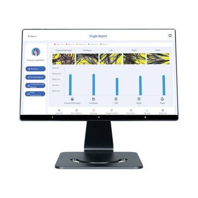 4 ভাষা স্মার্ট আল স্ক্যাল্প বিশ্লেষক চুলের স্ক্যাল্প যত্ন লক্ষ্যযুক্ত মাথা মেশিন